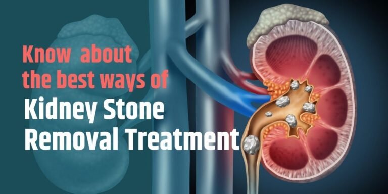 Read more about the article Punitam: A New Era in Kidney Stone Removal