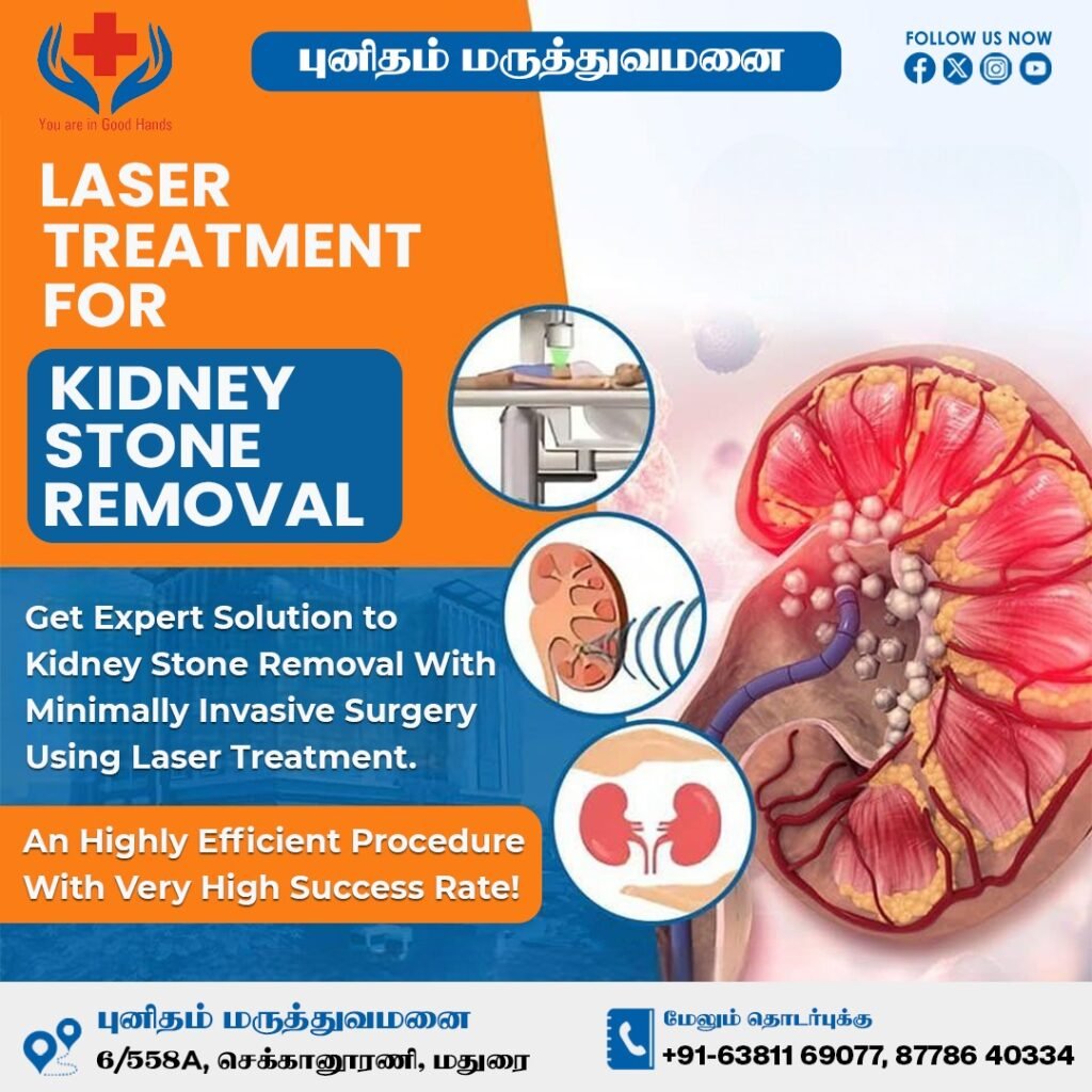 kidney stone surgery in Madurai